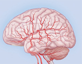Дисциркуляторная энцефалопатия головного мозга