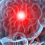 Как улучшить кровообращение головного мозга: препараты и полезные советы